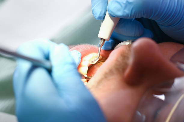 Best Pediatric Emergency Dentist in Mission Nyon, CA