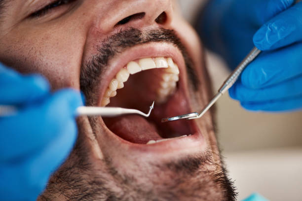 Best Emergency Cosmetic Dentistry in Mission Nyon, CA