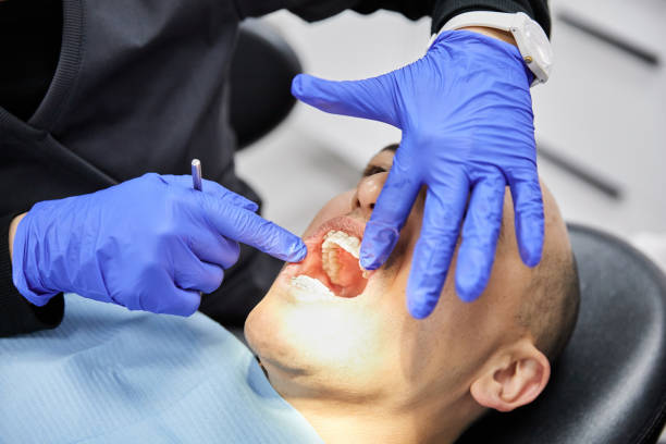 Best Mobile Emergency Dentist in Mission Nyon, CA