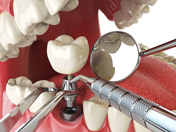 Best Emergency Dentist for Special Needs Patients in Mission Nyon, CA